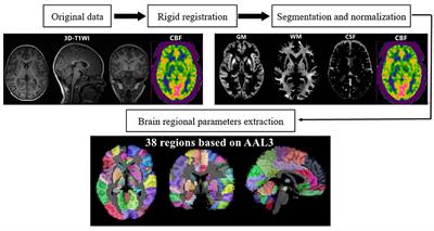 Application of Three-Dimensional Pseudocontinuous Arterial Spin Labeling Perfusion Imaging in the Brains of Children With Autism